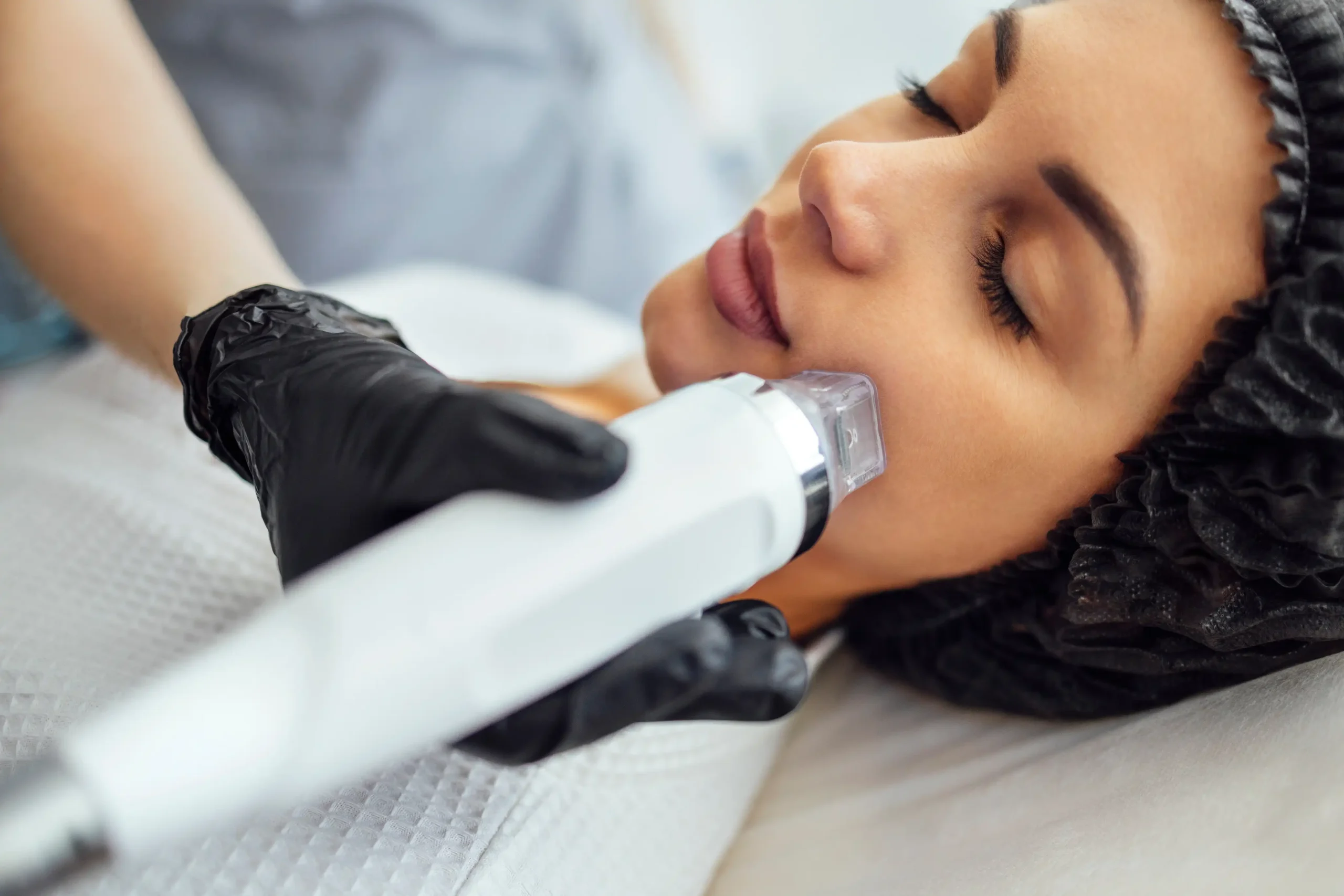 Microneedling Treatments in Southaven, MS