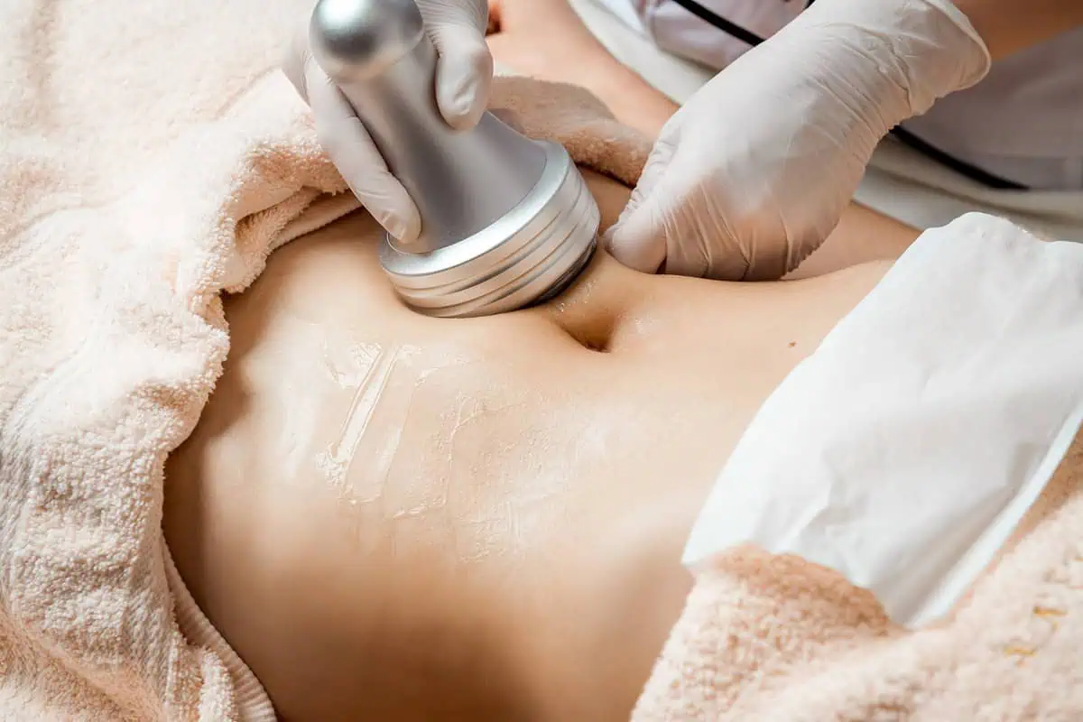 Body Contouring Treatment in Southaven, MS